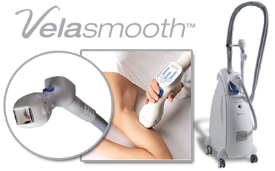 Trattare la cellulite con Velasmooth